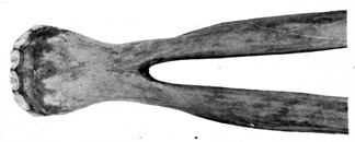 Lower jaw bone.